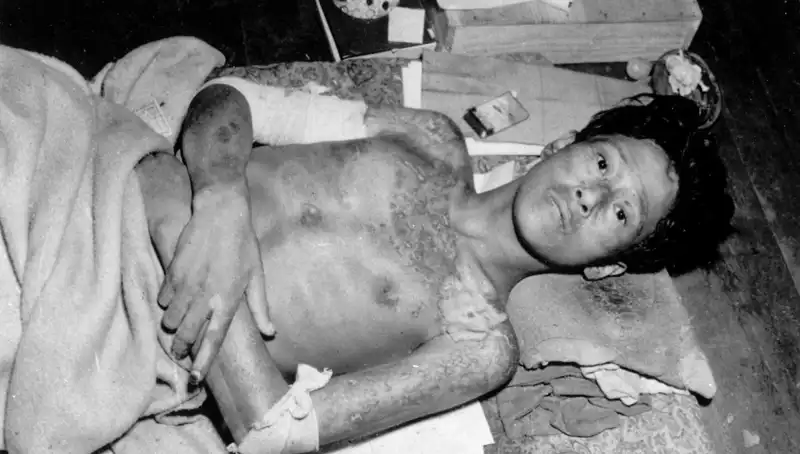 80 Yıl Sonra Nagasaki’den Sarsıcı Uyarı: Nükleer Felaket Tehlikesi