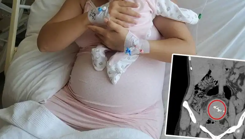 Doğumda Unutulan Bebek, İki Yıl Sonra Gazlı Bez İhmaline Soruşturma Açtı