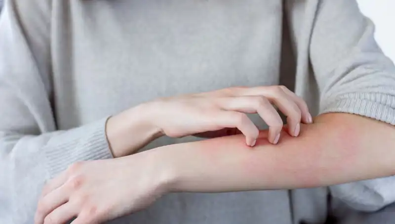 Cilt Kanserinin İki Gizli Belirtisi: Dermatologdan Önemli Uyarılar